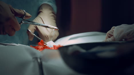 closeup surgeon hands stitching wound after successful operation in clinic.