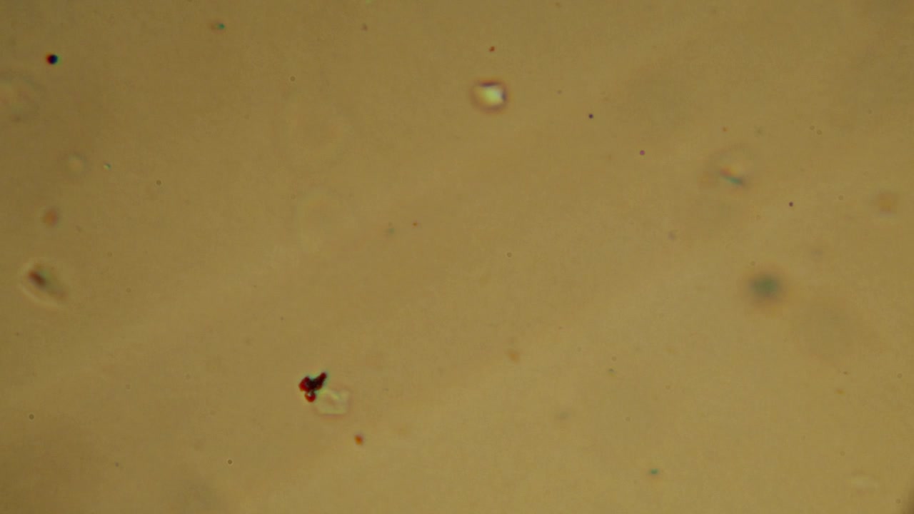 Microscopic View of Moving Microorganisms in Fluid