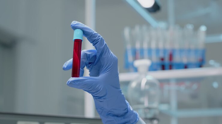Blood Sample Analysis in Medical Lab