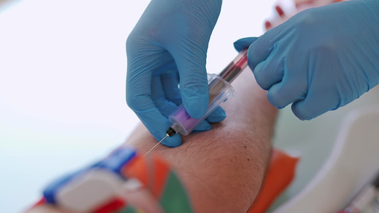 Close-up view of a needle on man's arm to collect blood into syringe. Medical worker in gloves taking blood sample from vein.