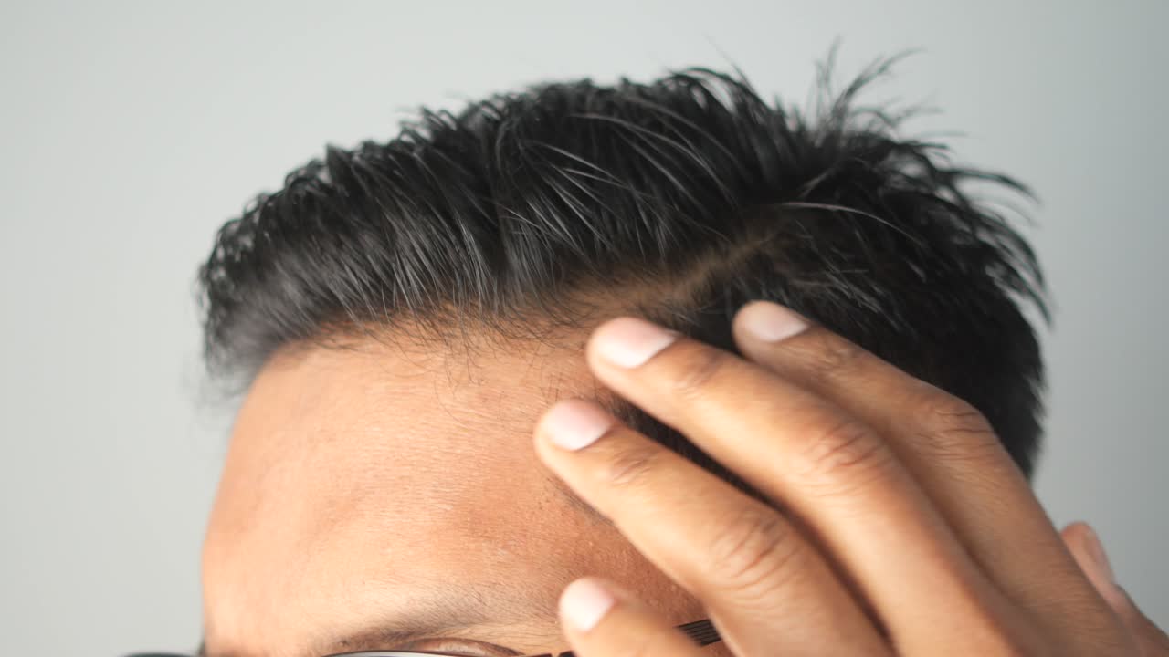 남자 의 머리 와 머리카락 의 클로즈업