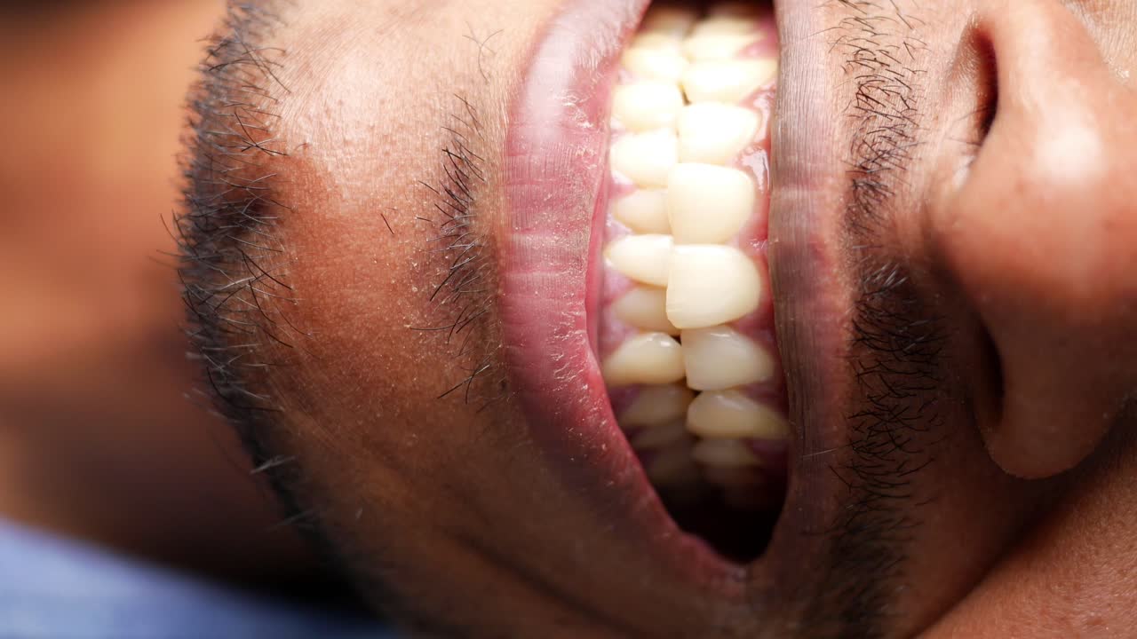 Close-up view of a person's open mouth and teeth.