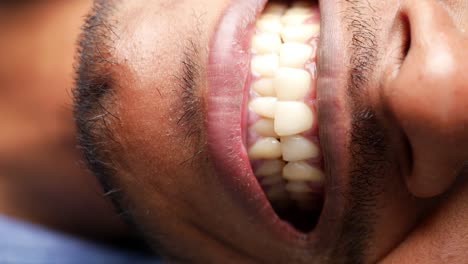 close-up view of a person's open mouth and teeth.