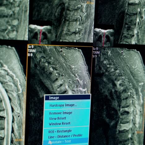 view of x-ray image