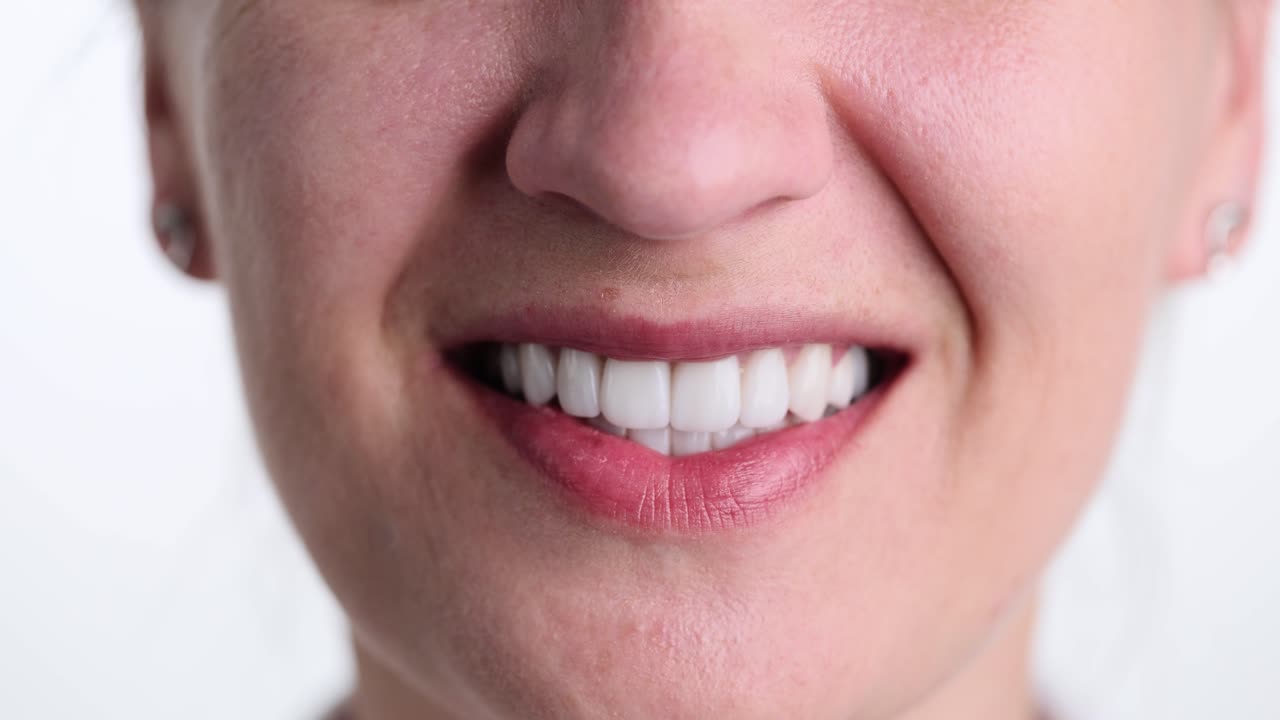 Close-up of a smile with perfect teeth