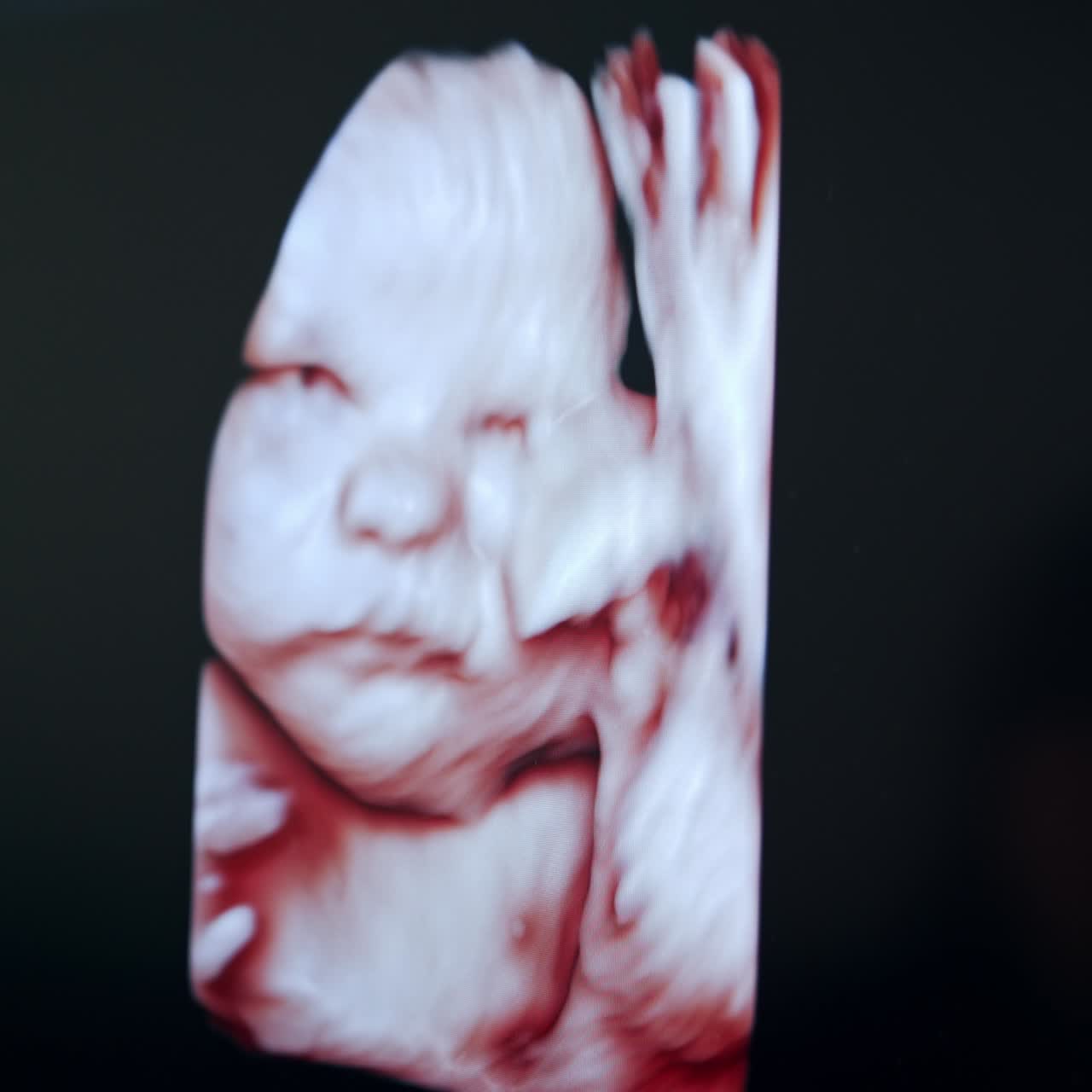Image of a baby on the screen of an ultrasound equipment. Close up. Black monitor with child in pregnant mum's belly