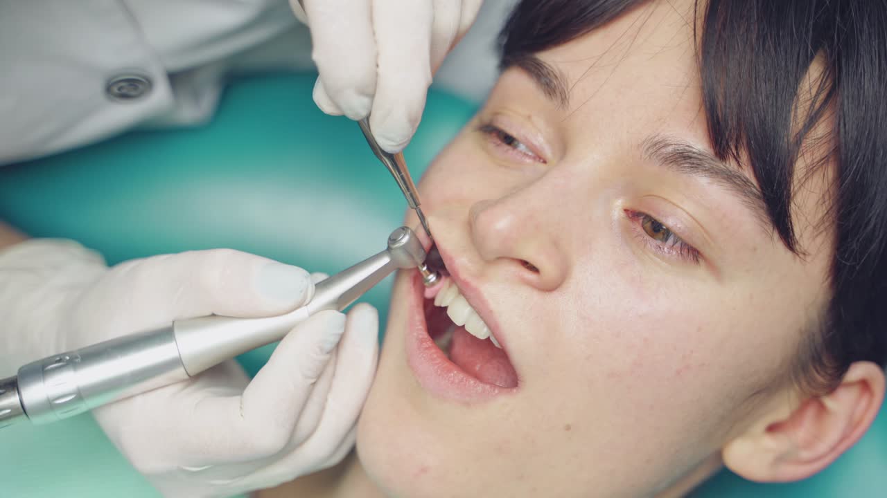 A dentist is doing the removal of deposits on the teeth and whitening for the client in the dental center. Close-up.