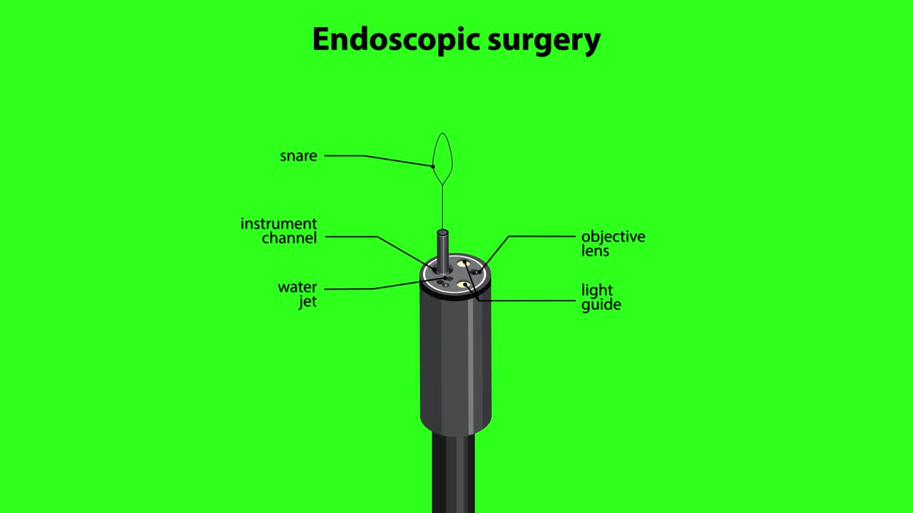 Medical animation illustrating endoscopic surgery in the colon, labeled instrument parts, green background, smooth transitions
