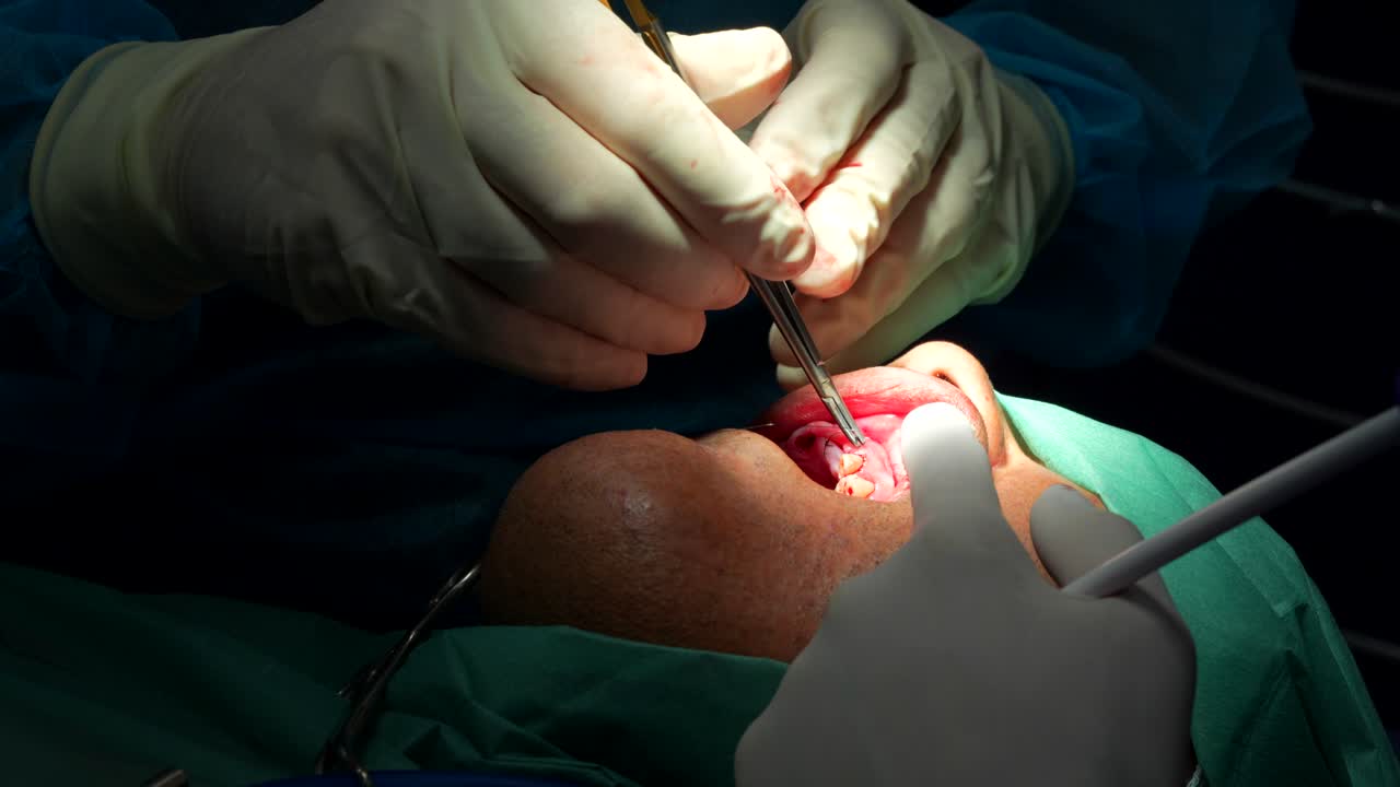 стоматолог шиет десны пациента шевной иглой и шевной ниткой во время операции.