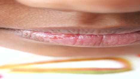 primer plano de las úlceras bucales en los labios del niño
