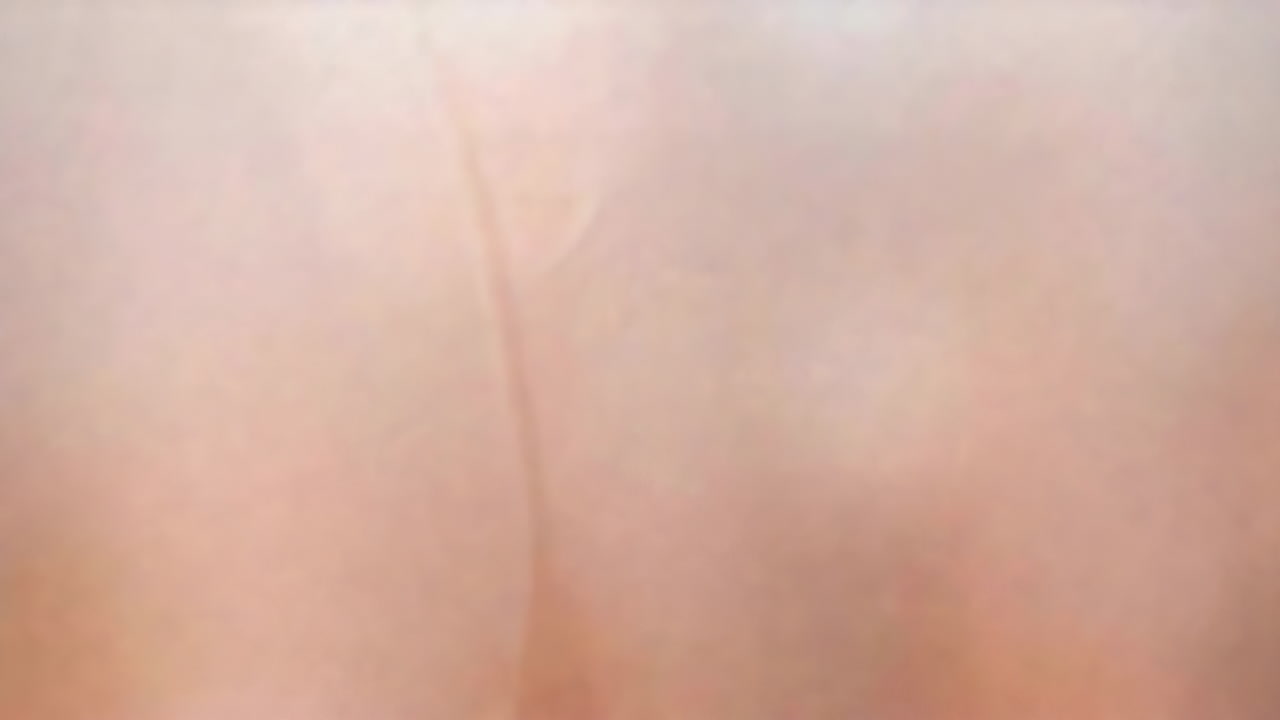 Close-up of human skin texture