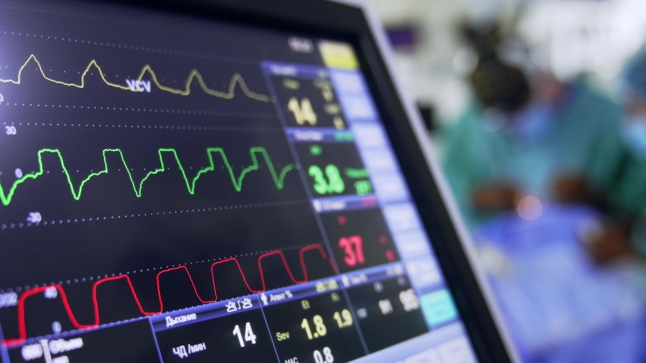 Linee curve dei parametri vitali sullo schermo nero di un ventilatore polmonare. Primo piano. Medici sfocati sullo sfondo.