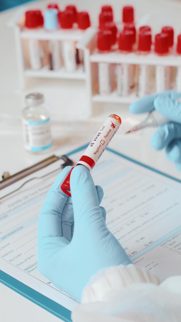 análisis de sangre para la detección del virus je en un laboratorio clínico