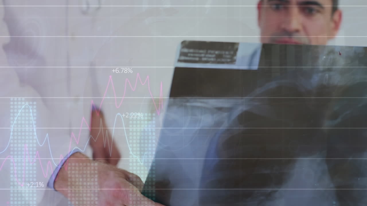 animación del procesamiento de datos estadísticos sobre dos médicos varones diferentes que examinan rayos x en el hospital