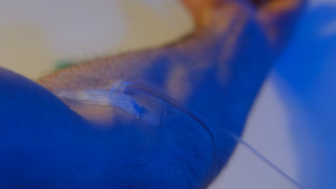 el brazo para donar sangre.