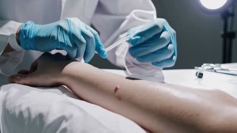 medical procedure on arm