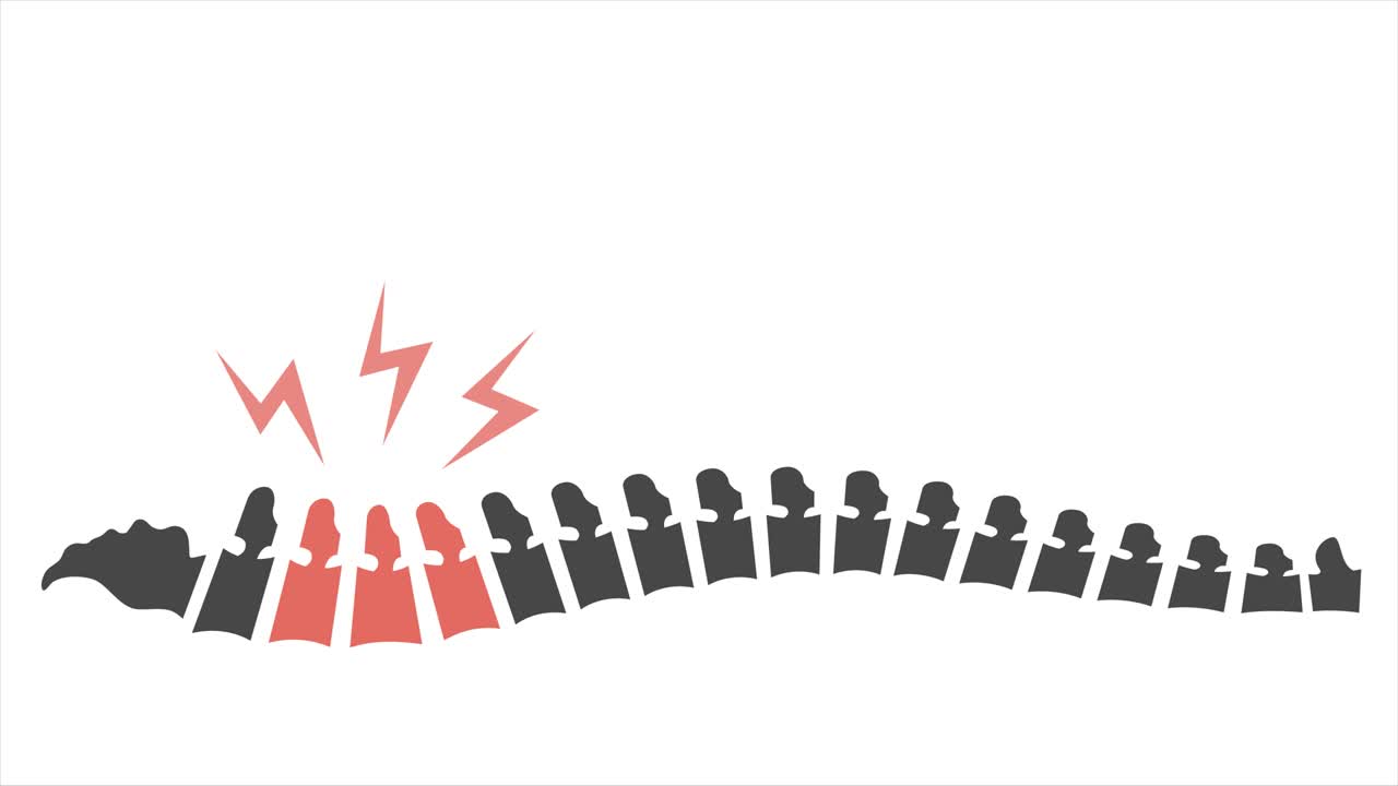 색으로 분리된 척추와 함께 척추 척추 지역에 초점을 맞추는 척추 통증 애니메이션 일러스트레이션