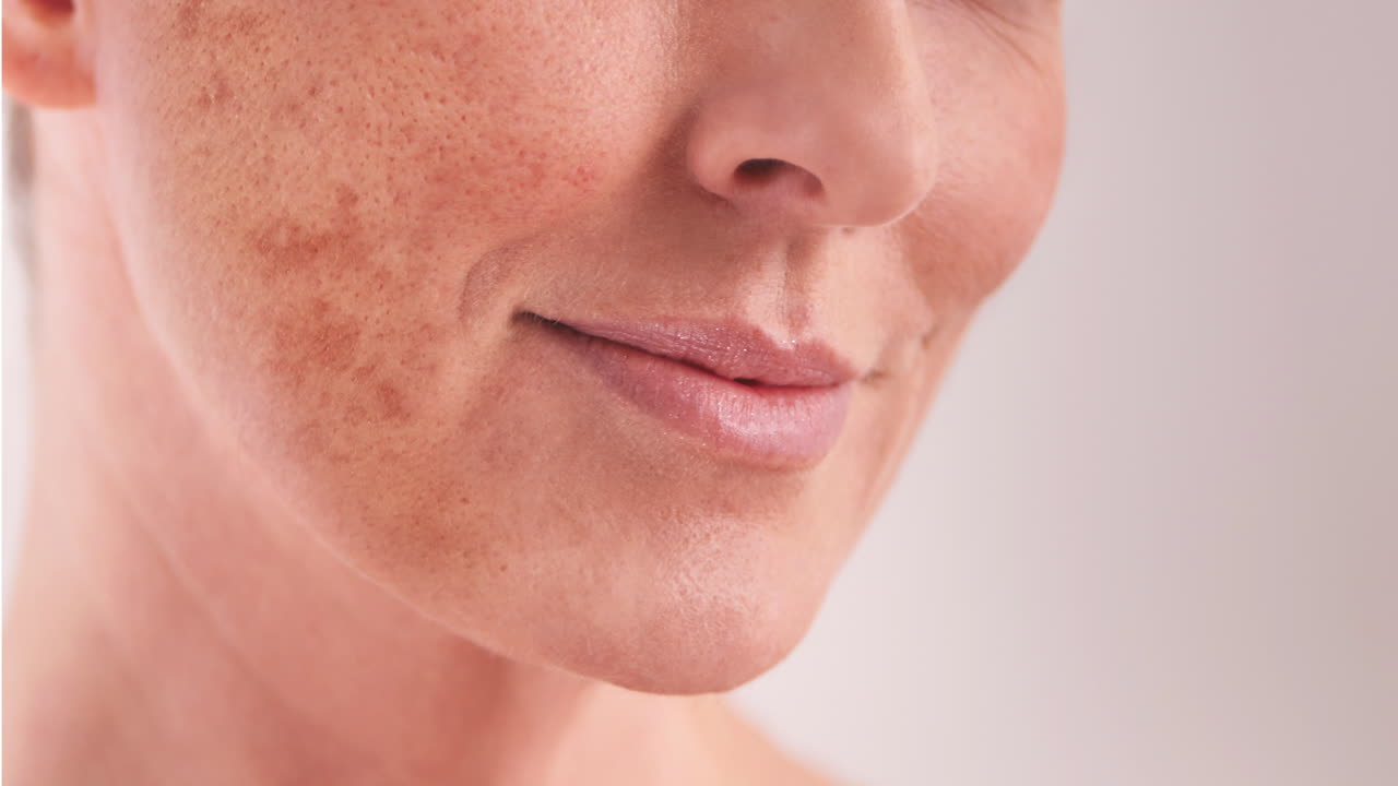 antes y después del tratamiento facial