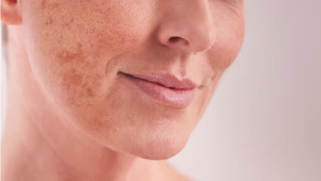 antes y después del tratamiento facial
