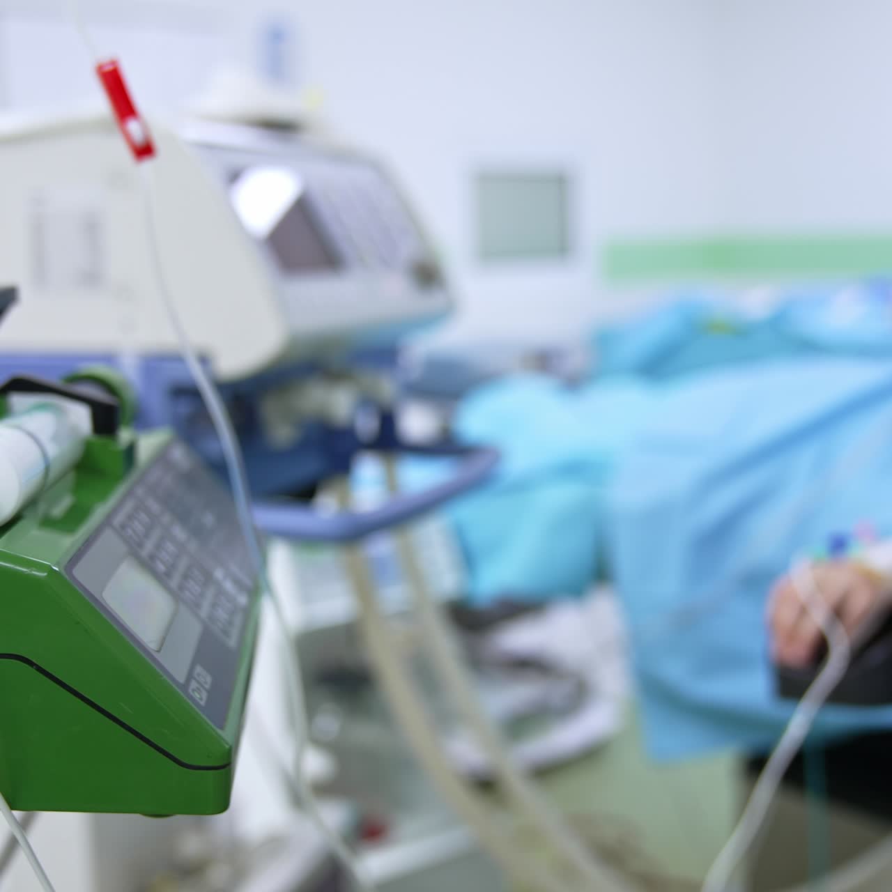 Apparatuses working in the surgery room. Advanced equipment at operation. Patient attached to the equipment at surgery table