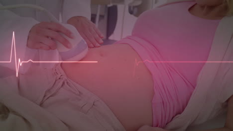monitor de latidos cardíacos sobre una doctora caucásica y una paciente embarazada que se somete a una ecografía