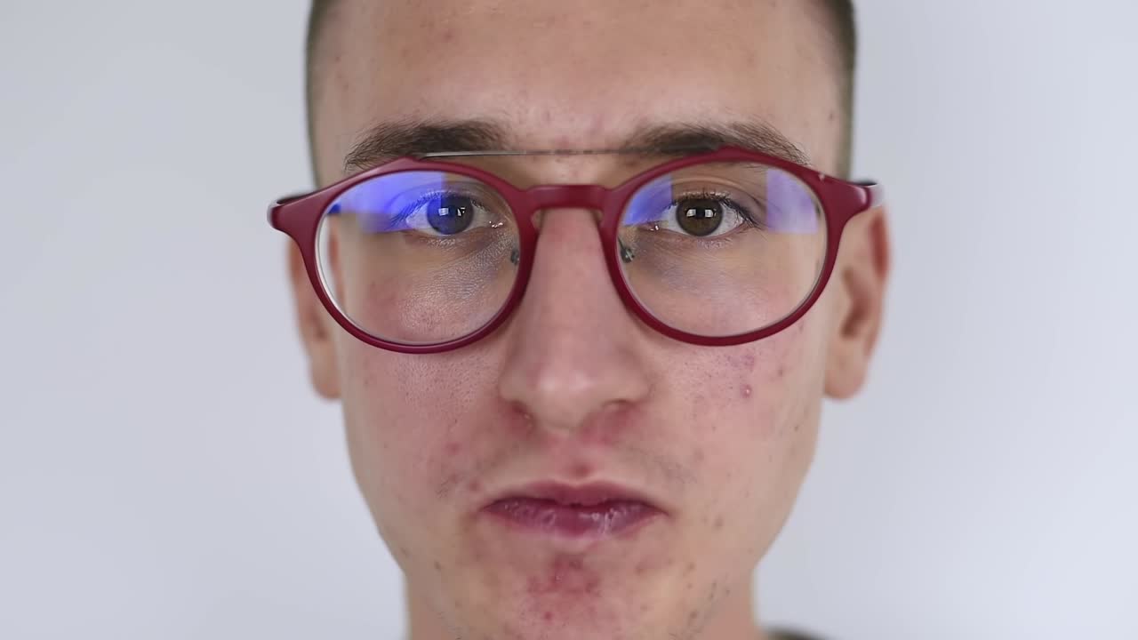 Young pimply man in red glasses eating onion rings while looking at the camera. White background. Close up. Junk food idea