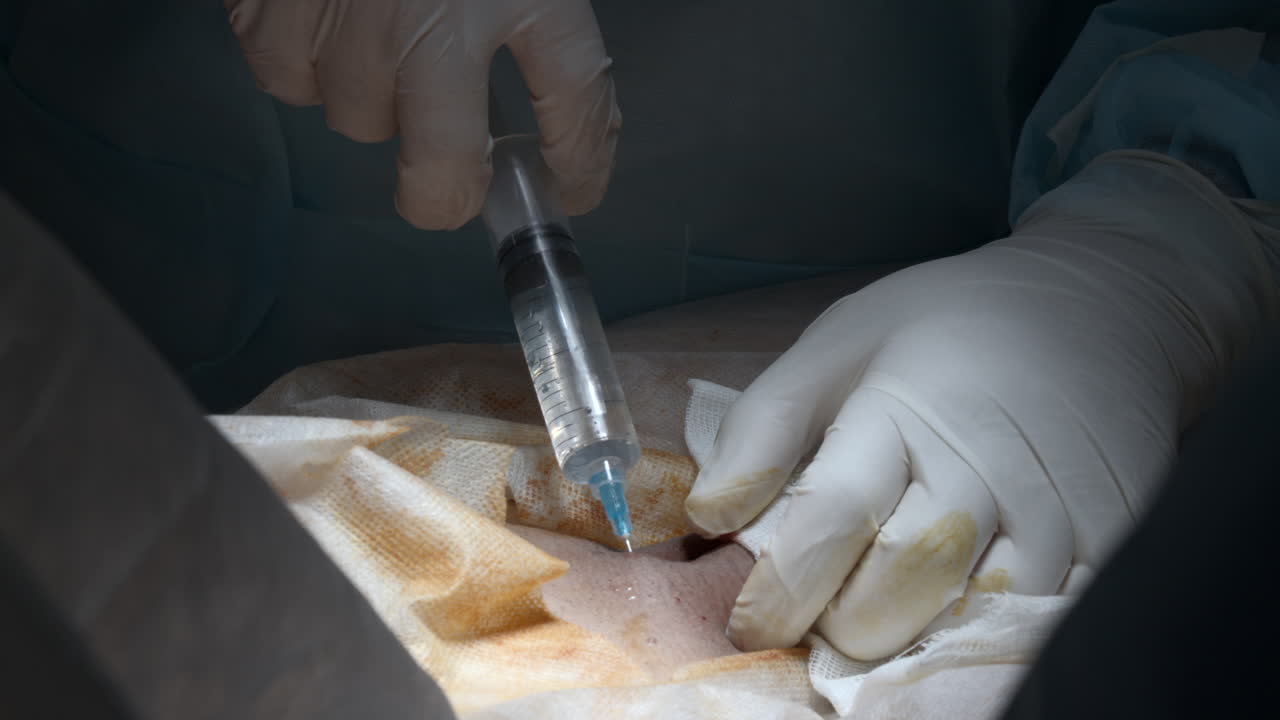 수술적 주사 절차