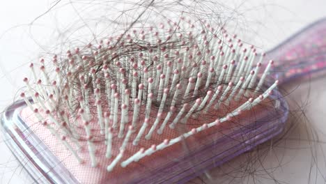 excessive hair shedding: a hairbrush full of lost strands