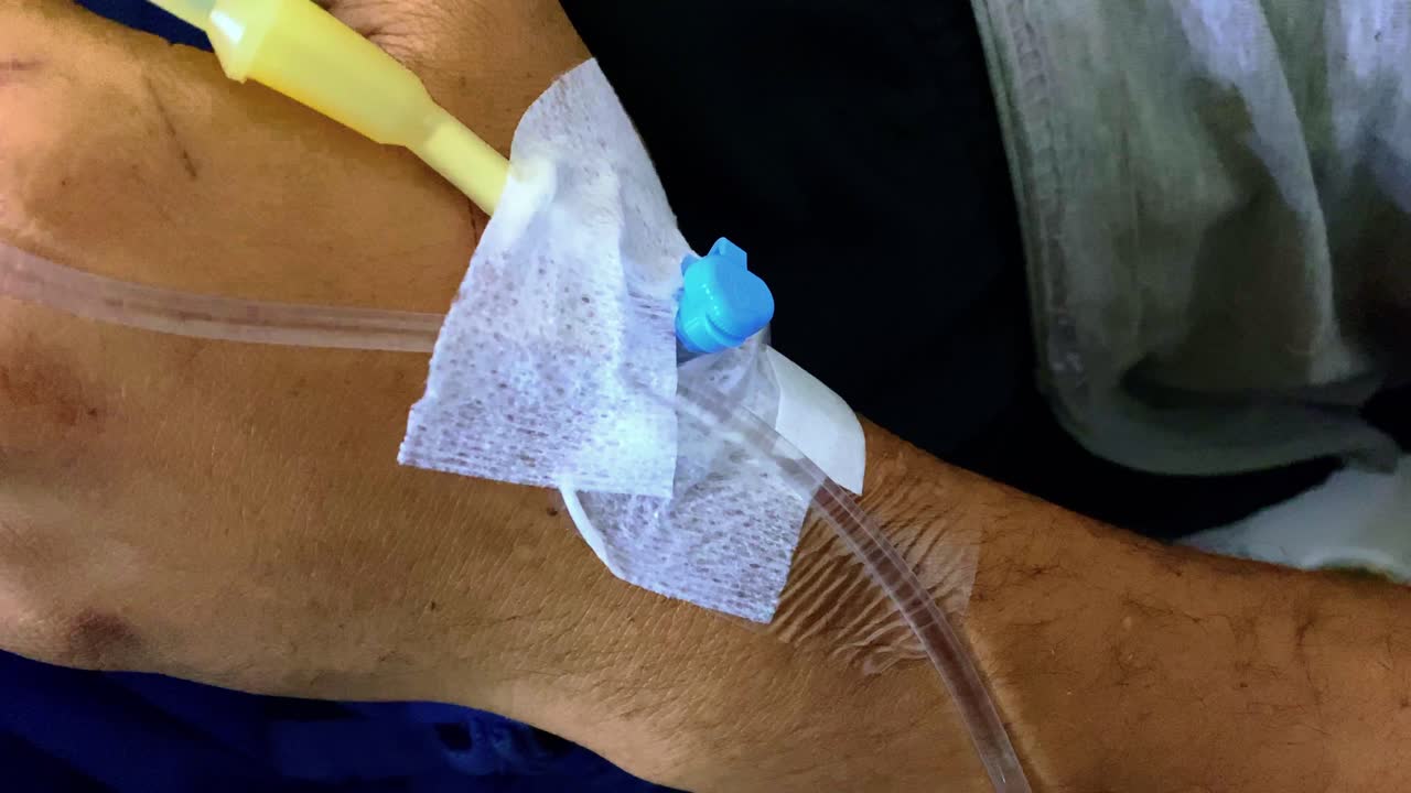 iv 튜브로 손을  ⁇ 르는 것