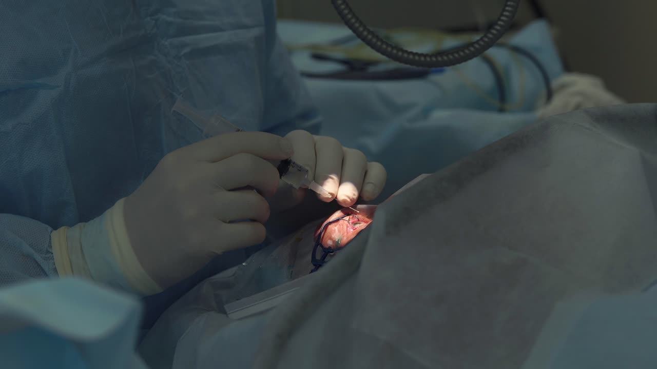 procedimiento de cirugía ocular