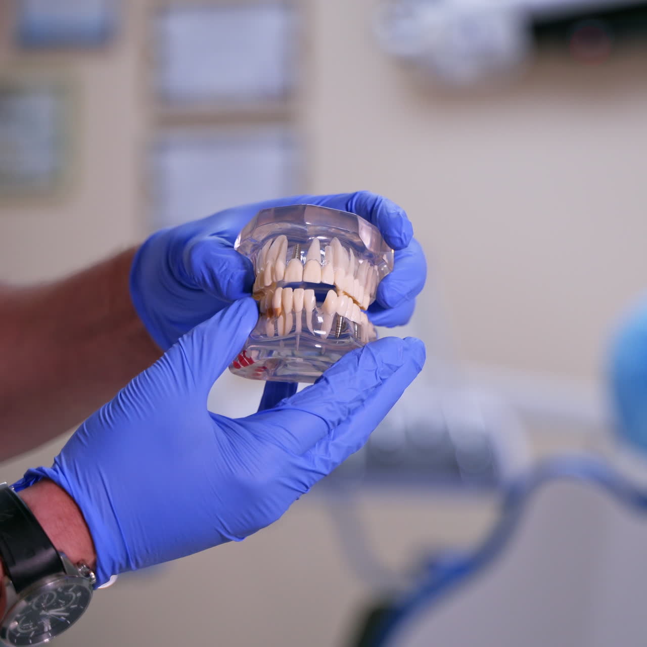 Artificial teeth in doctor's hands. Dentist shows on jaw model how to take out and put implant. Dental clinic. Close-up.