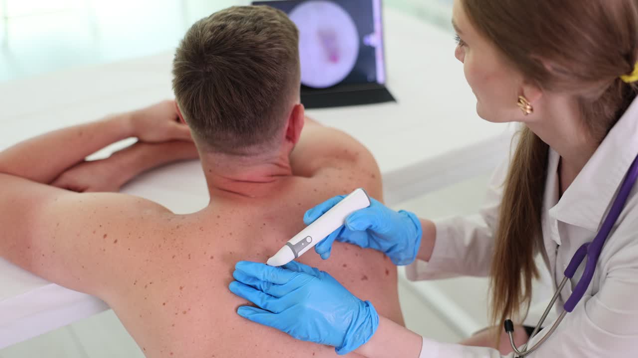 Dermatological Examination of Mole