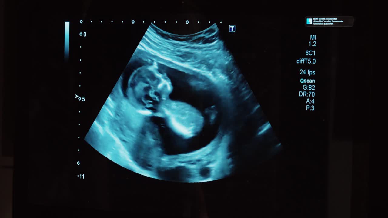 Primo piano di un'ecografia di gravidanza che mostra un bambino nell'utero mentre una mano indica il monitor. Concetto di cura prenatale, esame medico, monitoraggio della gravidanza e sviluppo fetale.