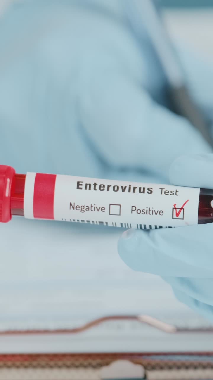 Detailed examination of ebolavirus blood test results in a clinical setting