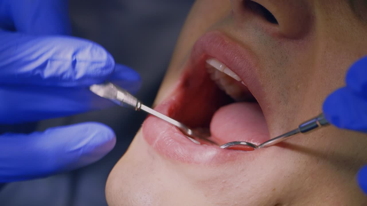 un dentista gira la lámpara hacia el paciente 1