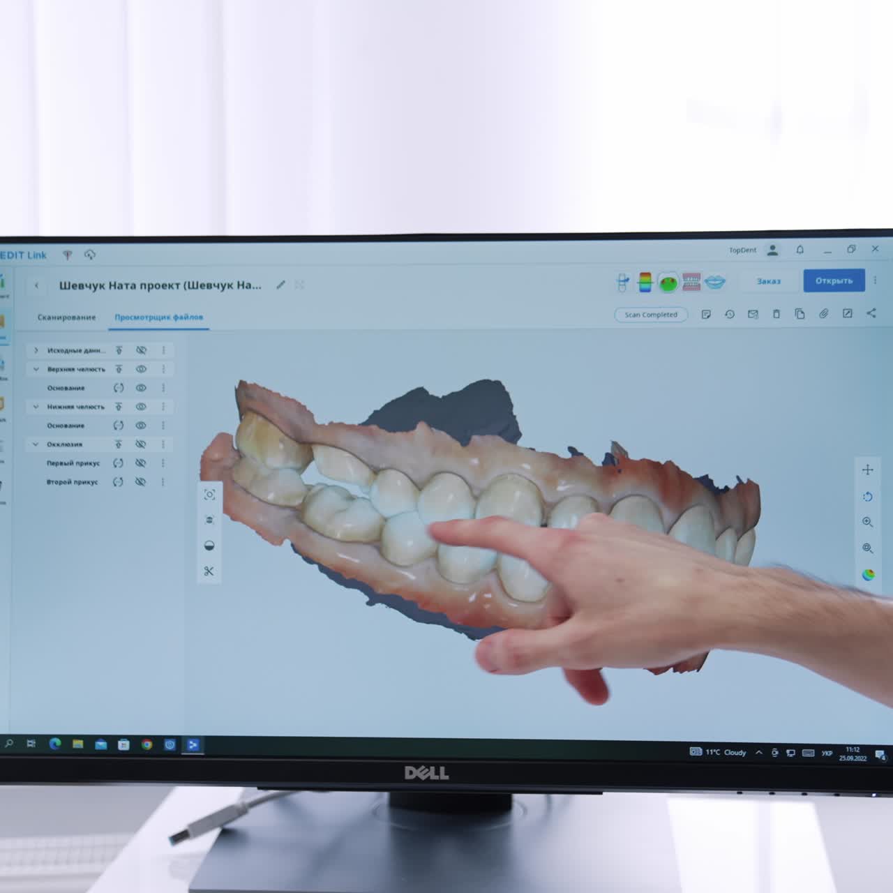 Dentist rotates the image of teeth projection on the sensor screen of computer. Patient is shown the result of treatment