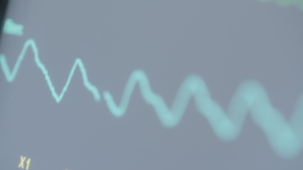 생체 징후를 보여주는 의료 모니터 디스플레이