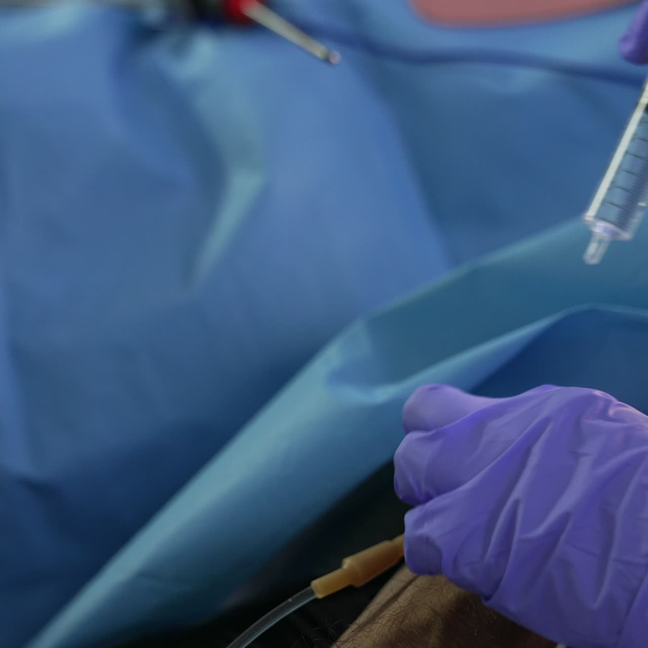 Medic's hands in latex gloves inputting the medicines in catheter attached to a patient's hand. Anesthesiologist's work at surgery. Close up