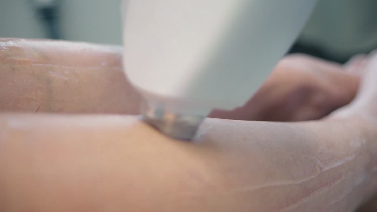 레이저 탈모 절차