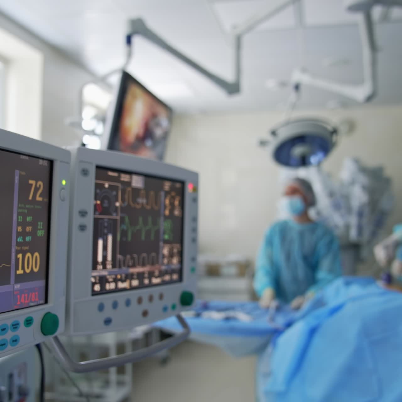 Moderna sala operatoria con monitor. Tracciati grafici sullo schermo del monitor mostrano l'elettrocardiogramma (ECG) e le condizioni del paziente durante l'intervento.