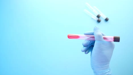 medical hand holding a blood sample test tube