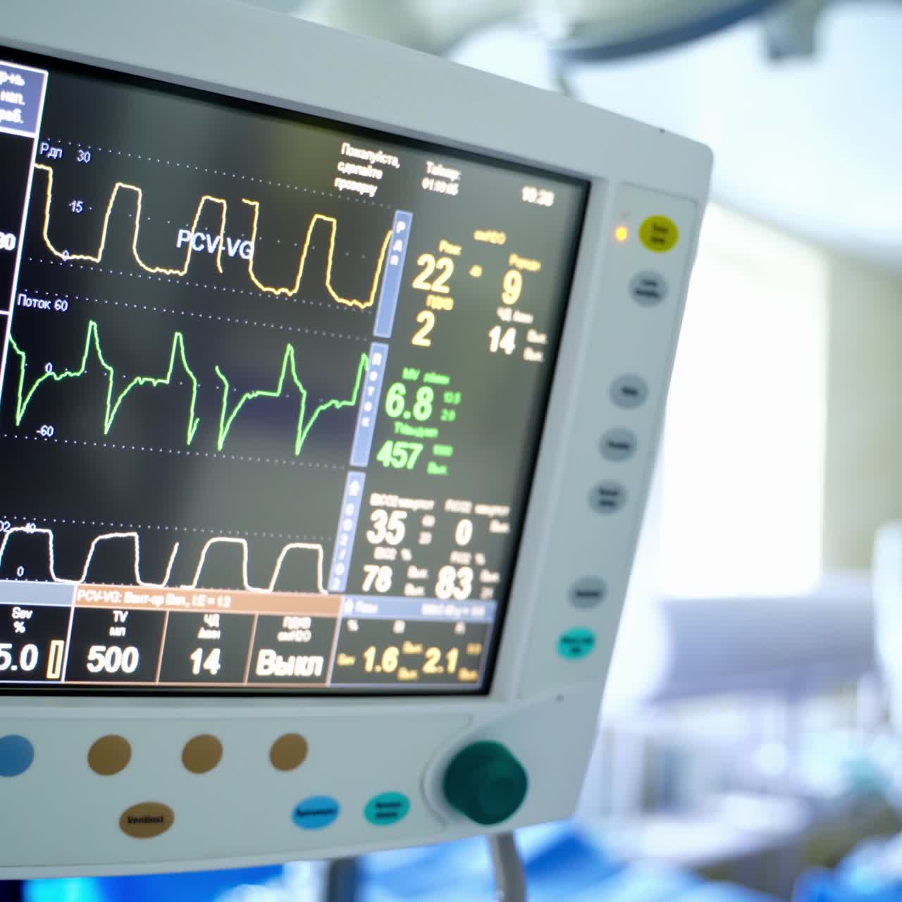 Signs of patient's condition on the screen. Heart rate monitor on blur surgical room background. Medical monitor displays graphs with vital signs of a patient