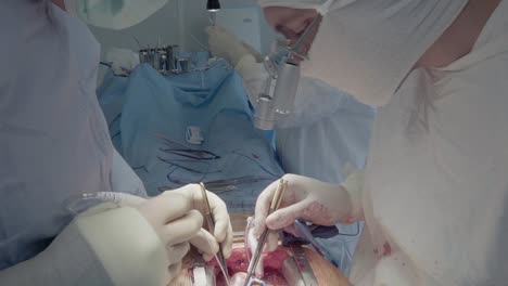 medical staff during a heart operation 3 close-up