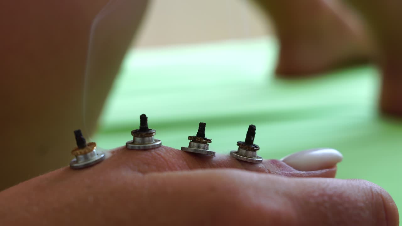 건강 센터에서 moxibustion 절차를 수행하는 치료사: moxibustion은 인체의 전체 표면에 위치한 생물학적으로 활동적인 지점에 대한 열 효과입니다.