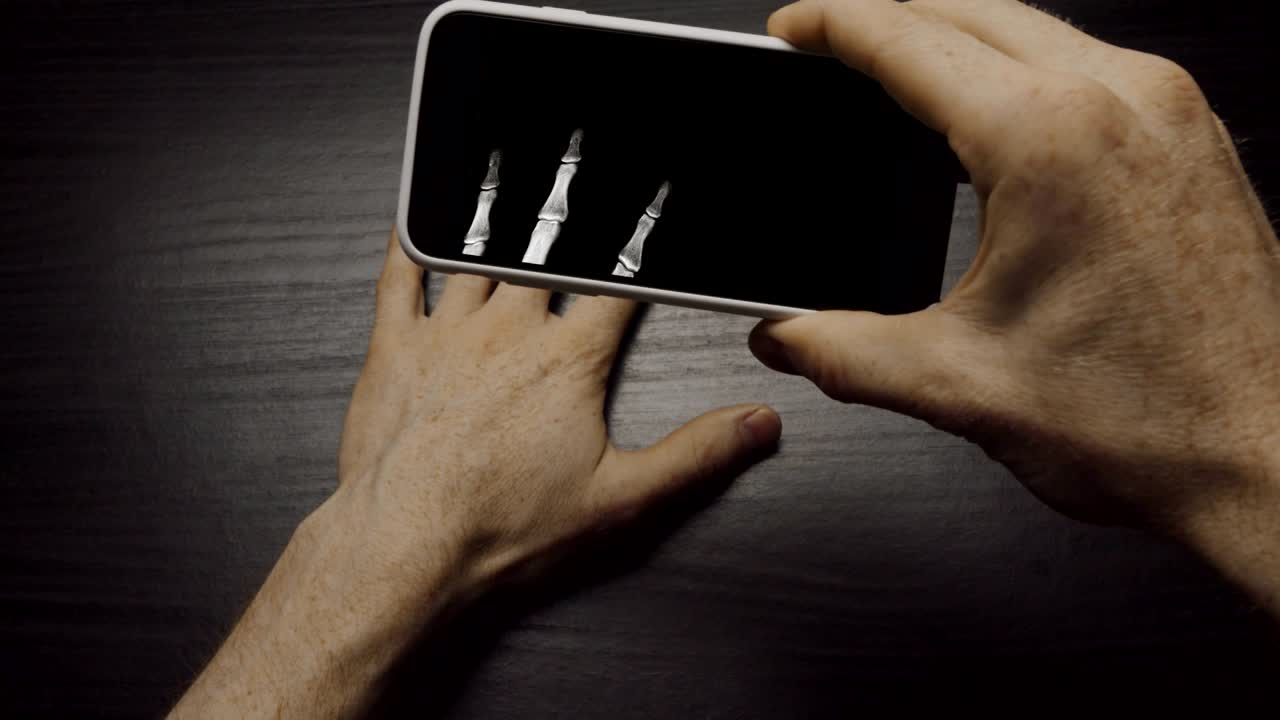 aplicación de rayos x que escanea la estructura ósea de la mano con un teléfono inteligente 4k