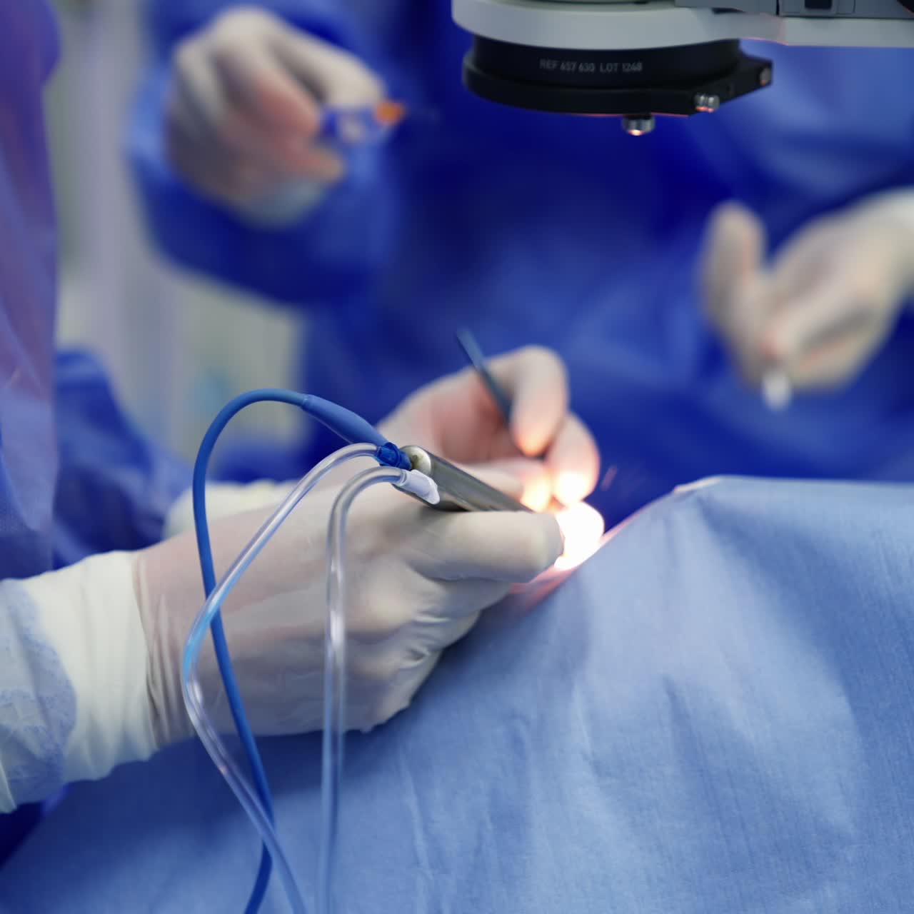 Patient during ophthalmic surgery