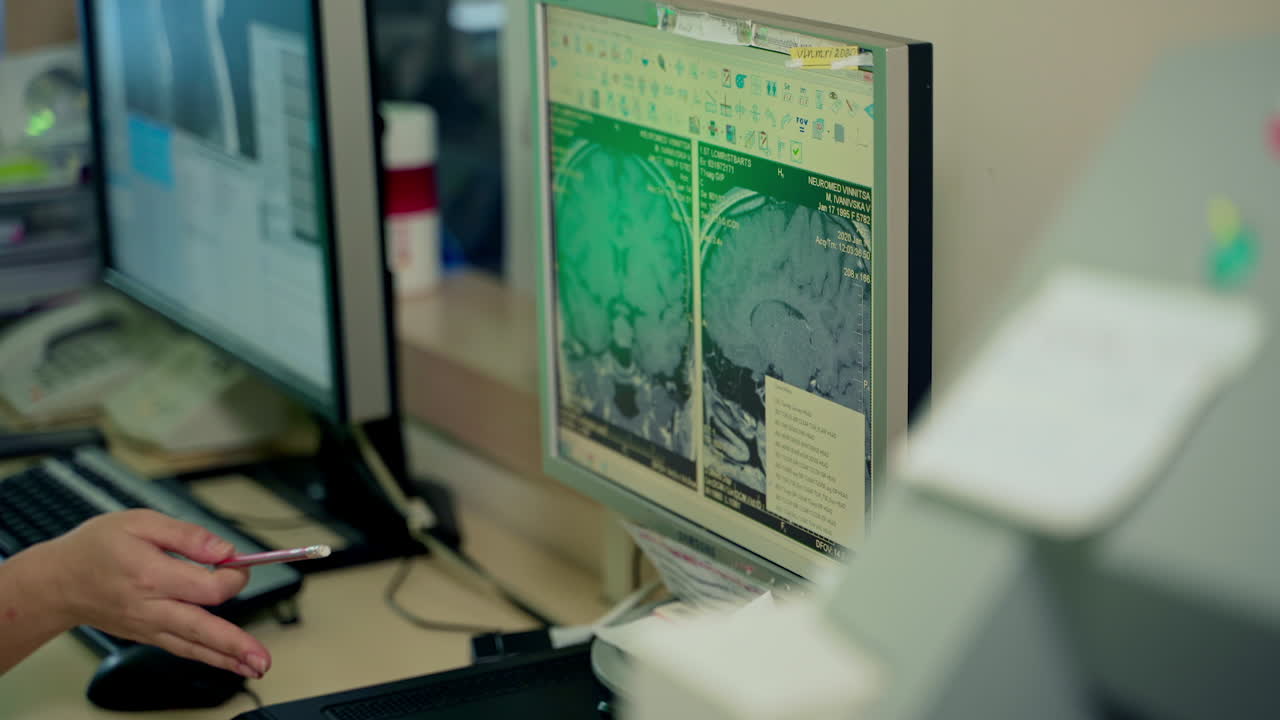 Doctor examine MRI results. Doctor in office looking at Xray results