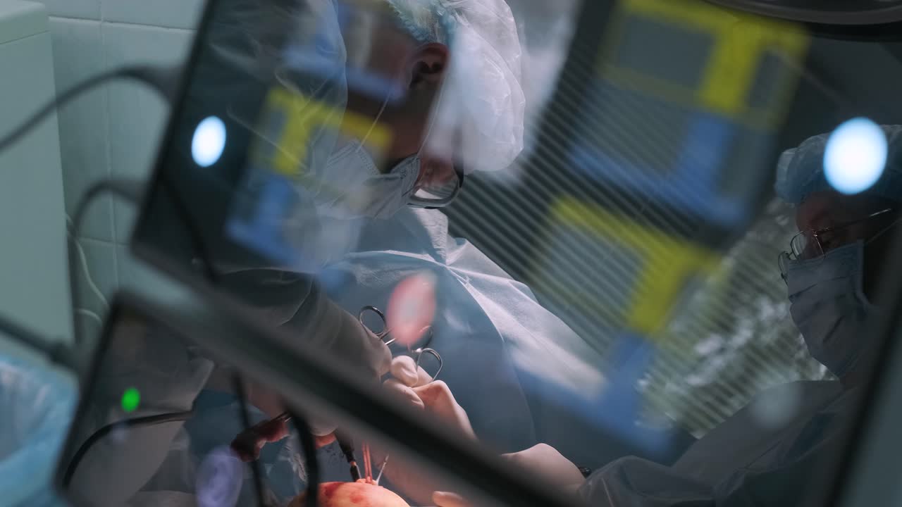 암 종양을 제거하는 수술: 수술을 수행하는 외과 의사, 장비의 거울 패널에 반사