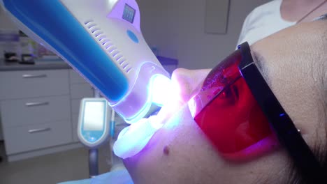 Young-woman-with-an-expander-in-mouth-and-red-protective-glasses-getting-UV-whitening-at-the-dentist's-office-by-an-ultra-violet-machine.-Shot-in-4k.