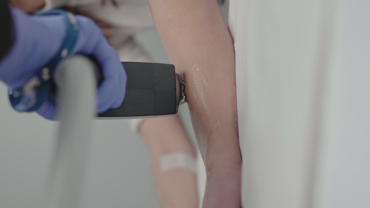 técnico realizando depilación láser en el brazo de una mujer con cubierta de tatuaje - video vertical